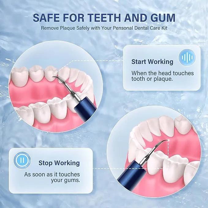 LED Light, Electric Cleaner Tool for Teeth, Teeth Cleaning Kit with 4 Modes USB image 4